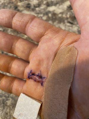 Rothman Orthopaedics