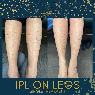 Andromeda Aesthetics