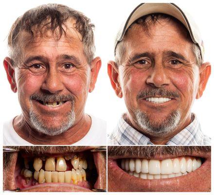 Chatt Implant Center