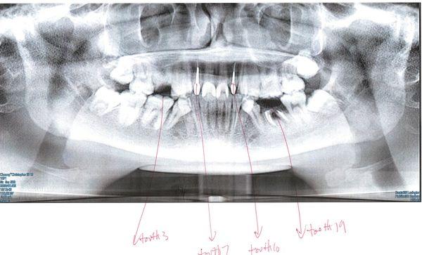 After Thomas Puschak's intentional malpractice and abuse