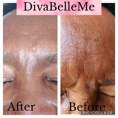 Skincare and wrinkle reduction treatments.