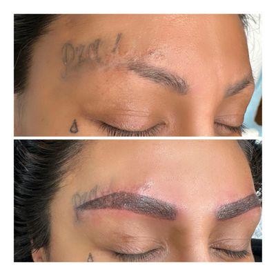 Micro-shade created brow on old scar that didn't allow hair regrowth. beautiful transformation.