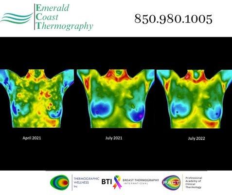 Emerald Coast Thermography