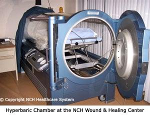 Hyperbaric Oxygen Therapy
