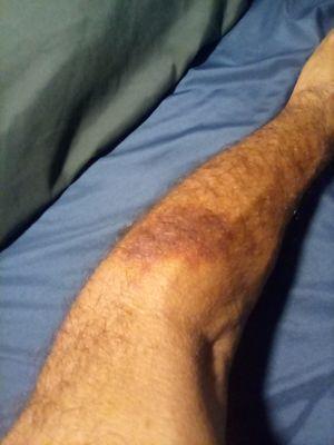 Kevin Yoo, MD - San Diego Neurosurgery