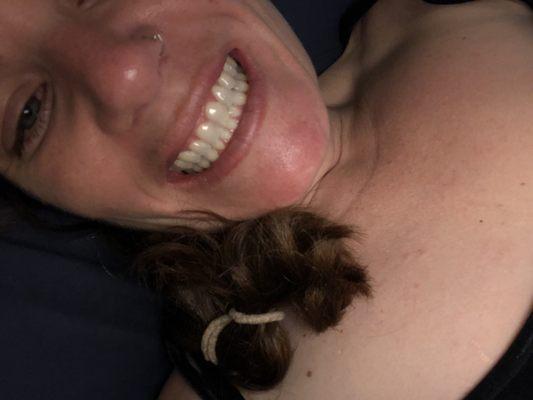 Literally the teeth they said I need braces for?! Save your time and money go to a well. Establish place!!