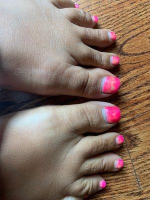 Bad/ Old gel polish - yellow stains just kept appearing over weeks time.