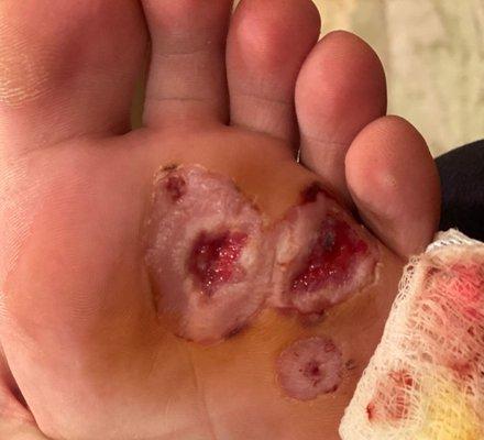 First Step Foot Care