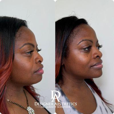 Designer Aesthetics by Dr Jarrett Schanzer