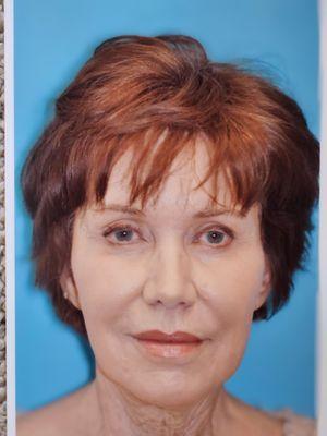 David A Hecht, MD, PC