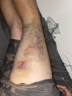 True Chiropractic San Diego