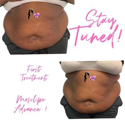 Packages are essential to your Full Body Needs . It's recommended to Book a Full Consultation