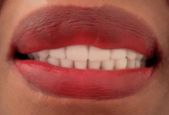 Precise Dental Studio