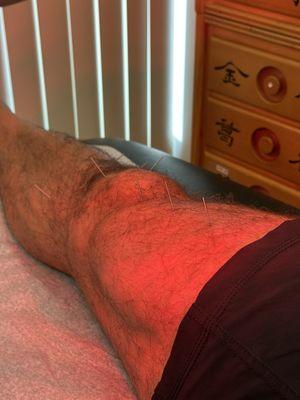 Kangs Acupuncture Clinic