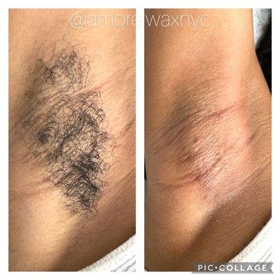 Before & After
Underarm Wax $15