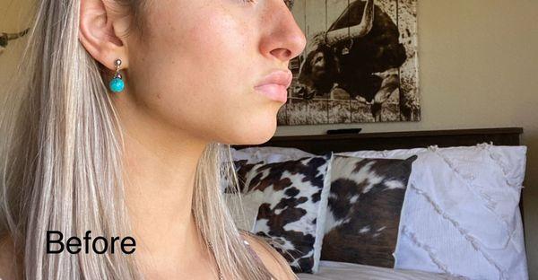 David A Hecht, MD, PC