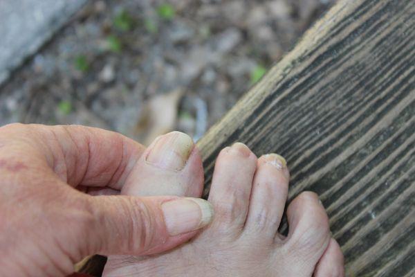 Charles M Miller, DPM