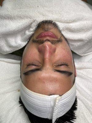 Naked Skin Aesthetics