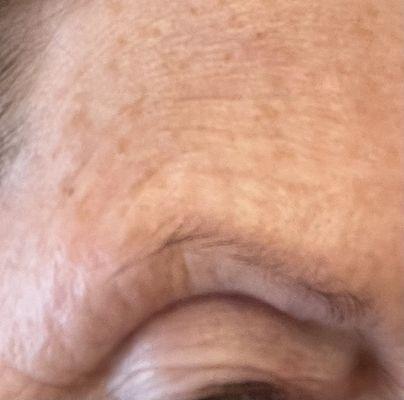 Wrinkles after 3 weeks