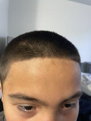 Crooked hairline and this is after i told her to fix it several times because it was way worse