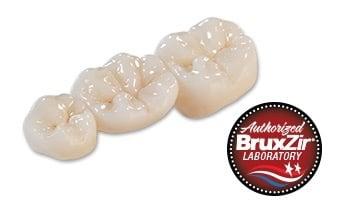 BruXir porcelain jacket crowns