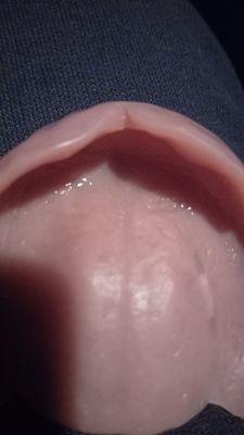 Affordable Dentures & Implants