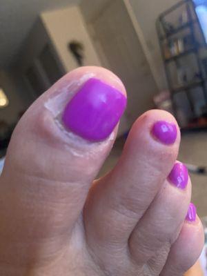 Terrible job and was charged $66.00 for the basic pedicure, gel polish and 2 tips on big toes. This is what my righttoe looked like today