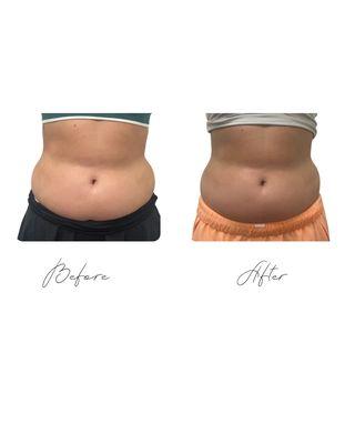 Results are visible as early as 3 sessions!
Book w/Crystal at Her Temple Wellness Spa
Now accepting cherry ! Treat now pay later