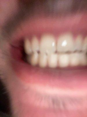 Living Dental Health