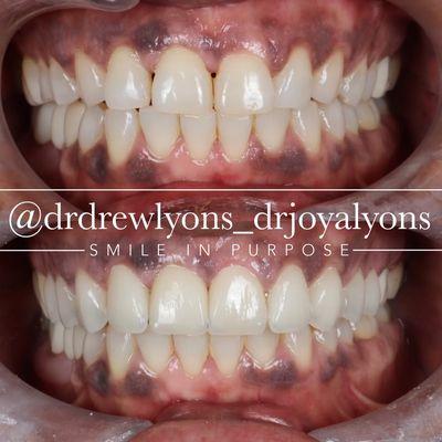 Smile Savvy Cosmetic Dentistry