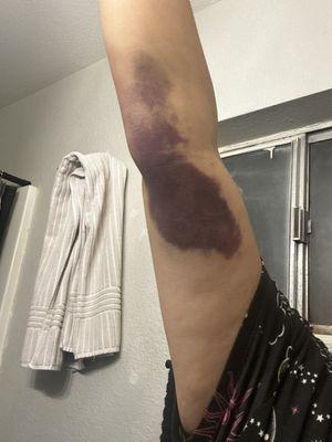 This is from today. 2 weeks after donation.