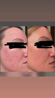 Allure Skin and Laser