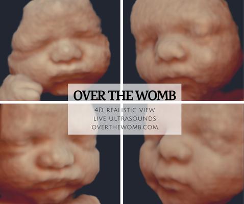 Over the Womb 4D Ultrasound & Photography