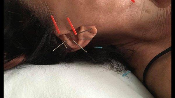 Christine Walinch, LAc