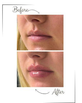 Another day another slay! Check out these gorgeous lips done by our PA Samira