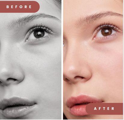 Skin Regeneration
