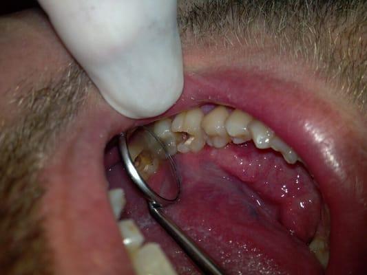 That's my empty tooth!