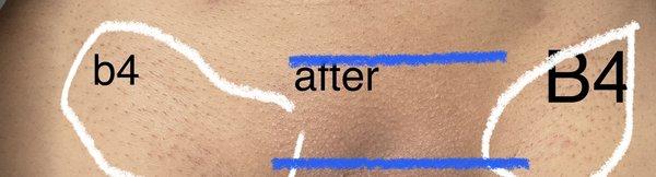 California Electrology Academy