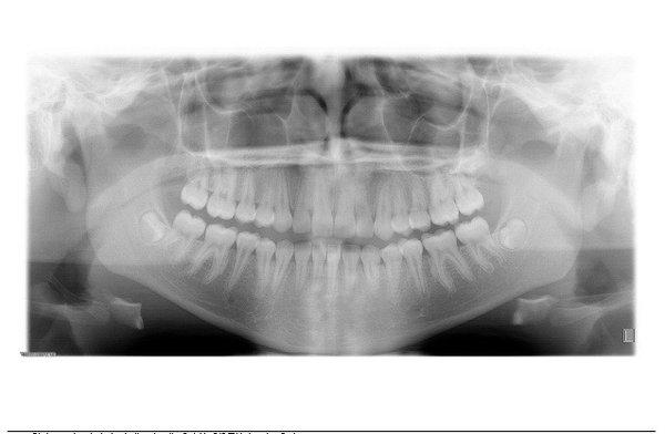 Alex J Brandon, DDS - Brandon Orthodontics