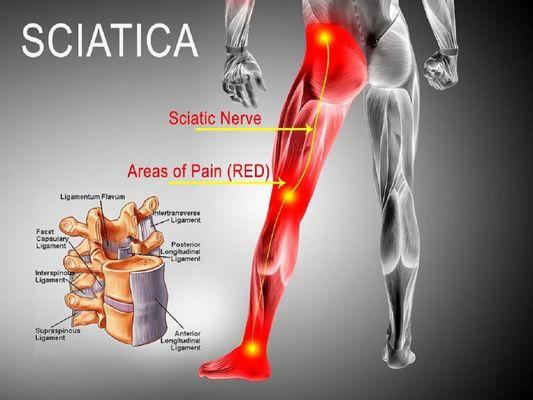 The sciatic nerve is located in the back of the leg. It supplies the muscles of the back of the knee and lower leg.