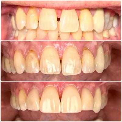 Idaho Family Dental Center