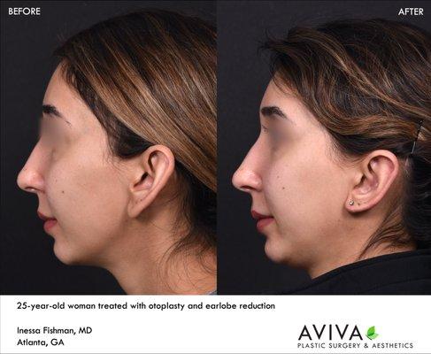 Aviva Plastic Surgery & Aesthetics