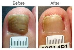 Weil Foot & Ankle Institute