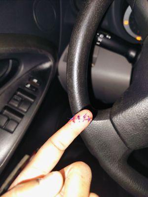 This is how deep the cut was. It's ugly!