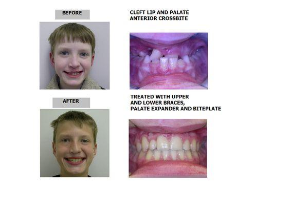 Cain Paul J, DDS