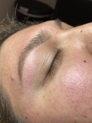 Brow shaping