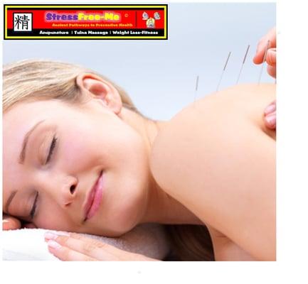 Acupuncture / Meridian Tuina Massage / Traditional Exercise