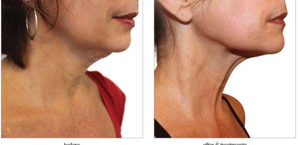 Glowing Skin Med Spa