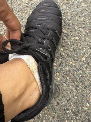 The restaurant failed to ensure that the picadinho was properly packaged.