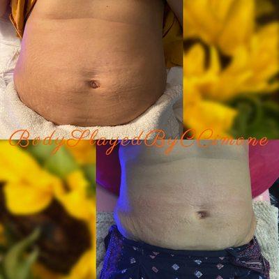3 sessions of body contouring services